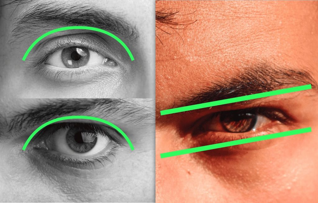 Non-Surgical Methods for Hunter Eyes